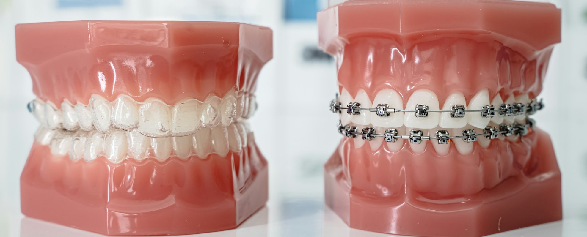 Ortodonție la NewOrtoSmile